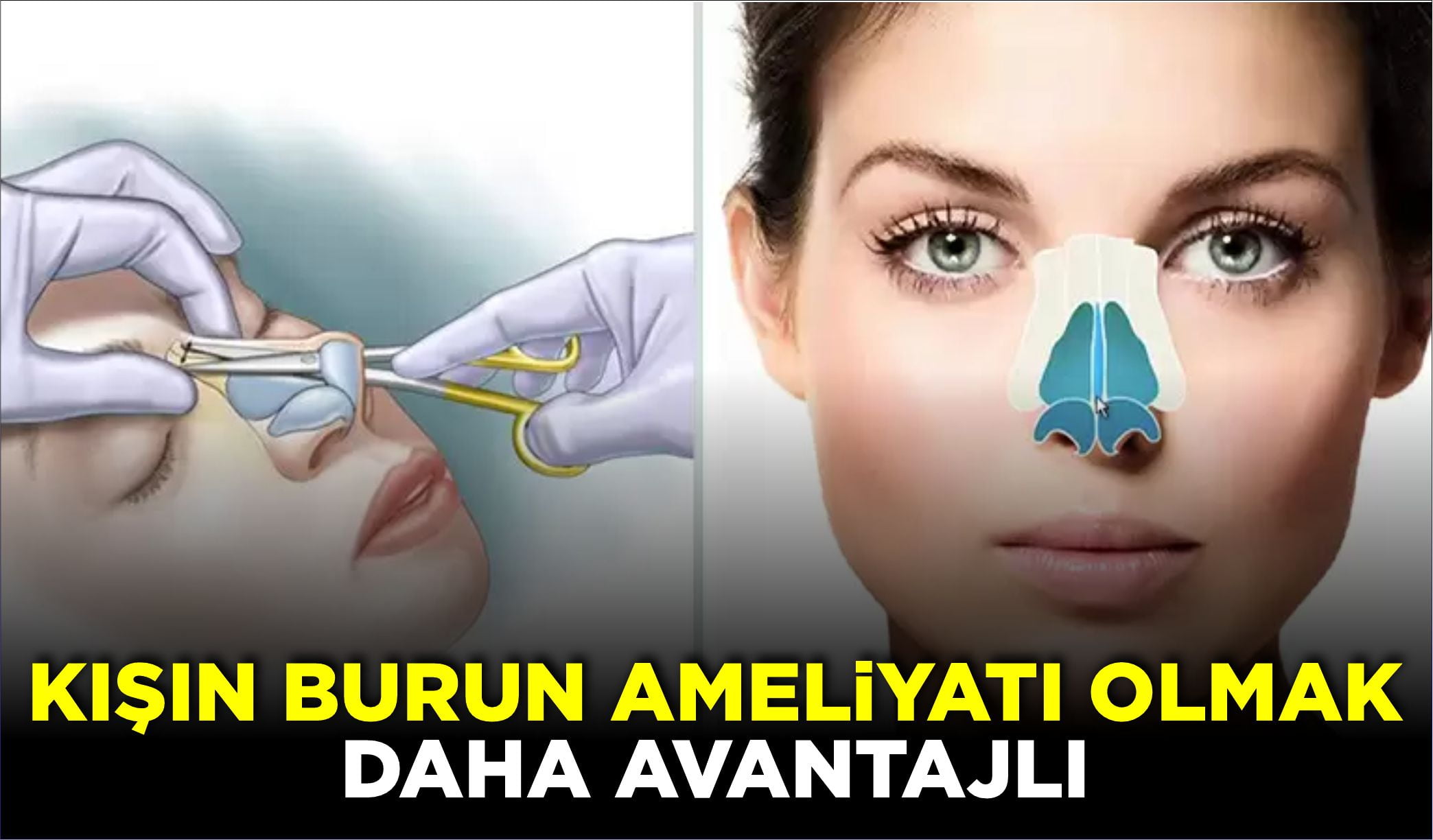 Toplumda kış aylarında burun