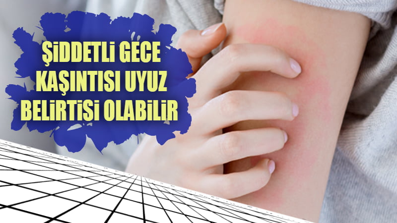 ŞİDDETLİ GECE KAŞINTISI UYUZ BELİRTİSİ OLABİLİR 