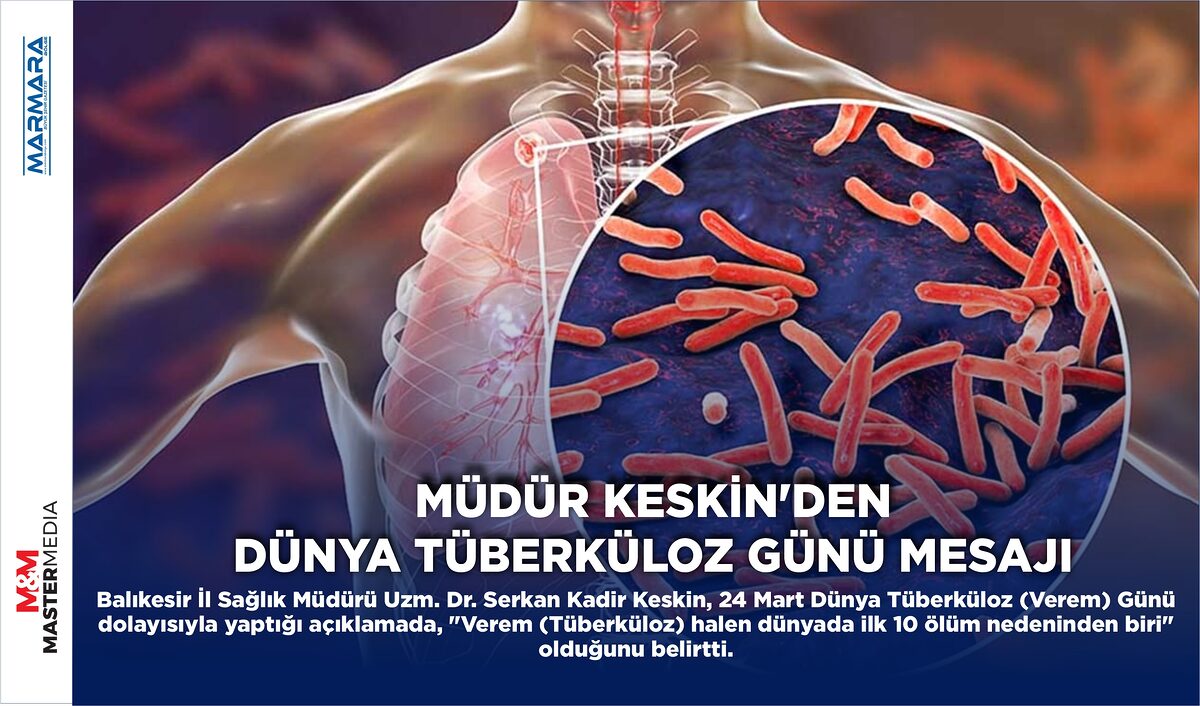 MÜDÜR KESKİN’DEN DÜNYA TÜBERKÜLOZ GÜNÜ MESAJI