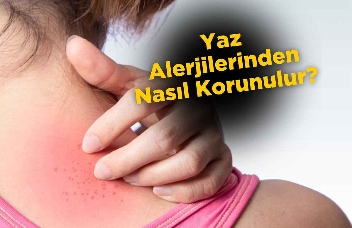 Yaz Alerjilerinden Nasıl Korunulur?