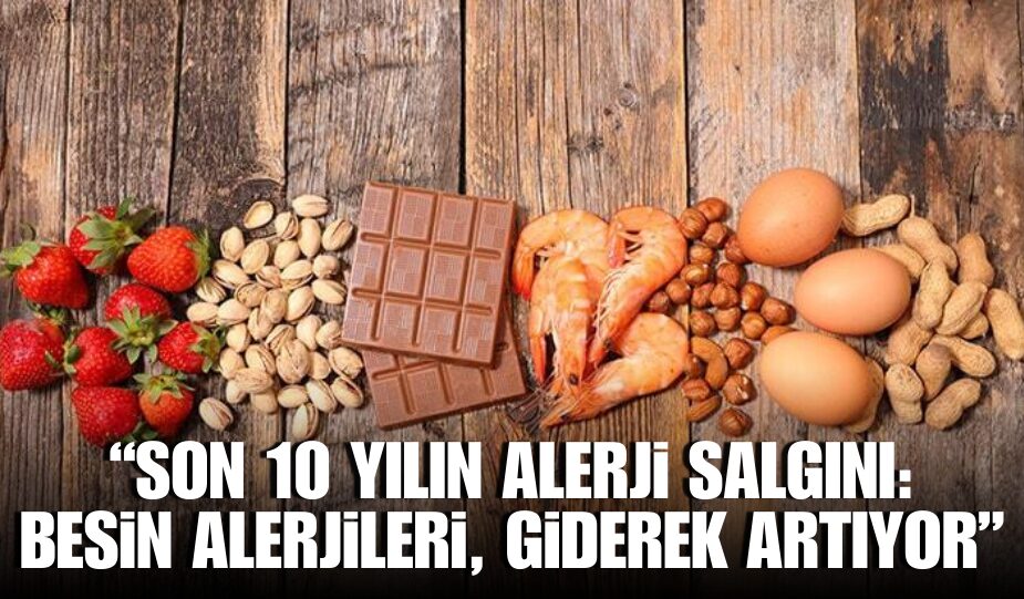 Son yıllarda besin alerjisinin