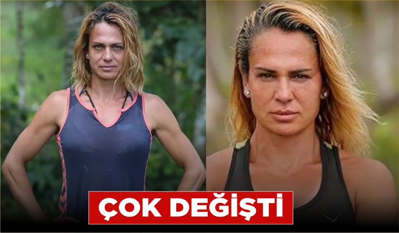 SURVİVOR NAGİHAN KARADERE’NİN SON HALİ ŞAŞIRTIYOR!