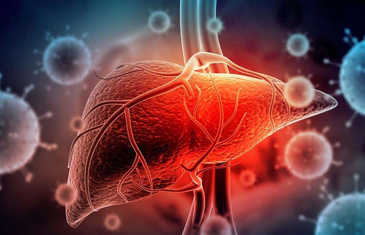 Hepatit Hastalığı: Belirtileri, Türleri ve Tedavi Yöntemleri