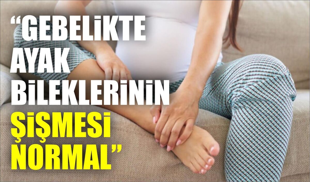 “GEBELİKTE AYAK BİLEKLERİNİN ŞİŞMESİ NORMAL”  