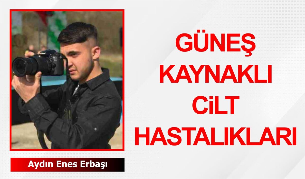 Güneş kaynaklı cilt hastalıkları,