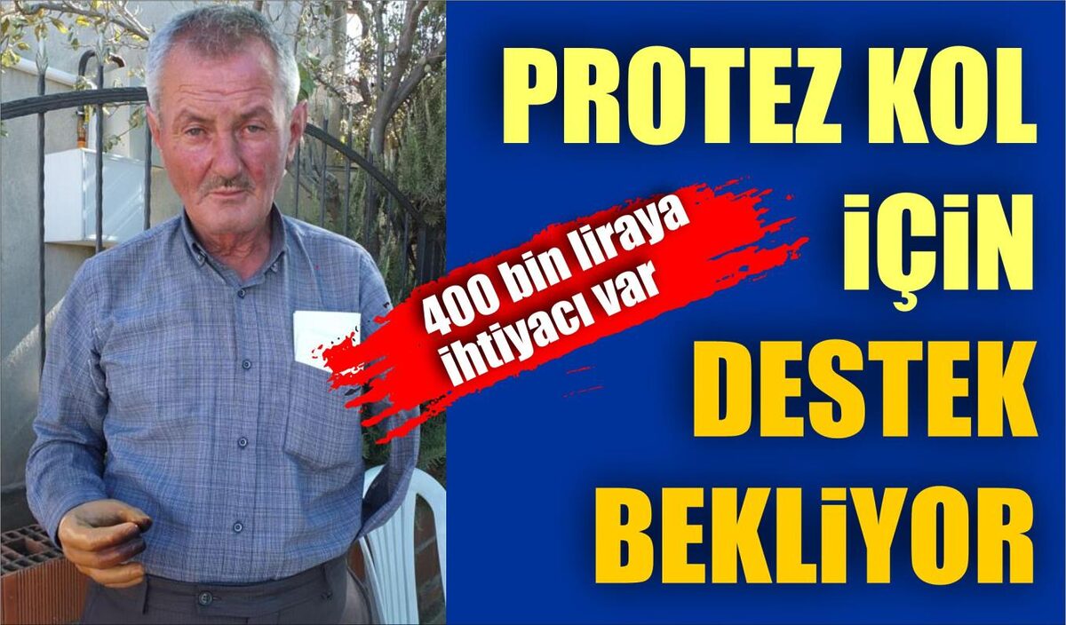 PROTEZ KOL İÇİN DESTEK BEKLİYOR  400 BİN LİRAYA İHTİYACI VAR  