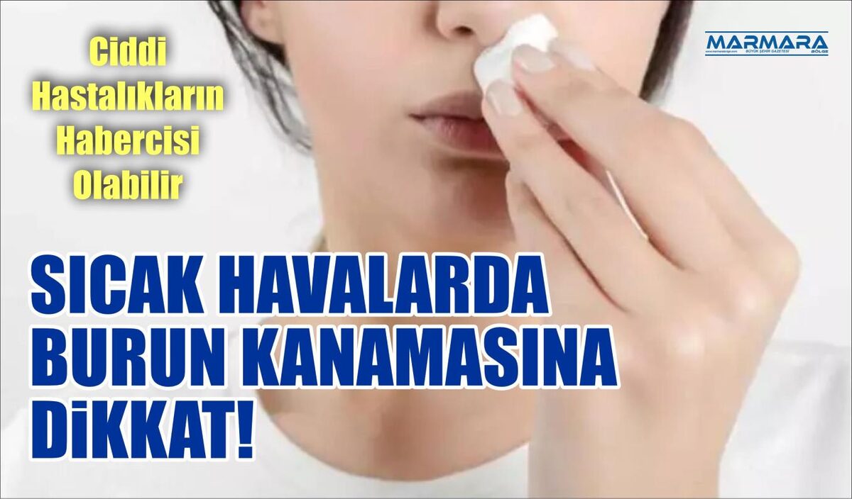 SICAK HAVALARDA BURUN KANAMASINA DİKKAT!