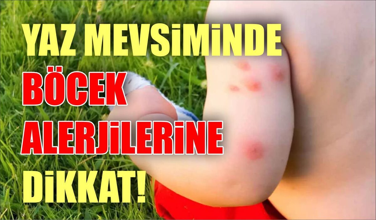 Gıda alerjisine karşı çocukların