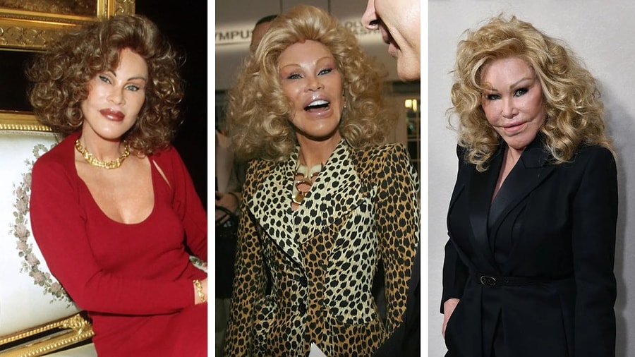 Jocelyn Wildenstein, yüz estetikleri