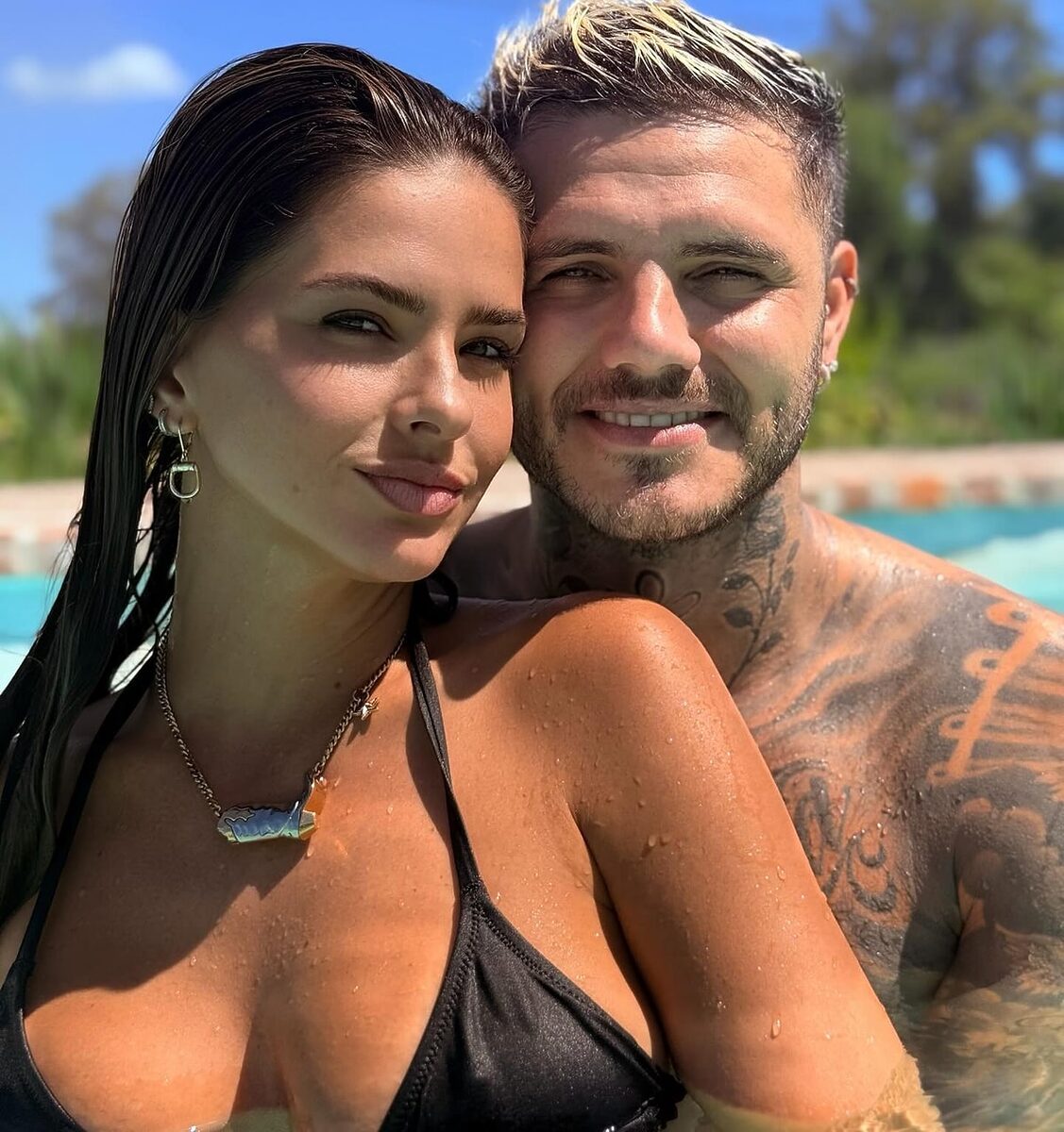 Galatasaray’ın Arjantinli yıldızı Mauro Icardi’nin sakatlığına rağmen sosyal medyada paylaştığı