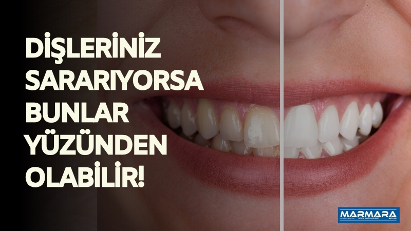 Çay, kahve, sigara ve yetersiz hijyen dişlerin doğal beyazlığını kaybetmesine