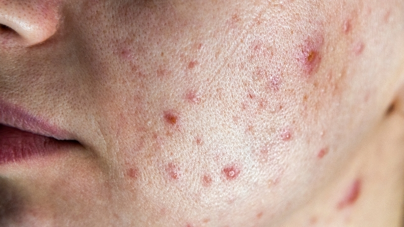 Adsiz tasarim 3 3 - Marmara Bölge Gazetesi