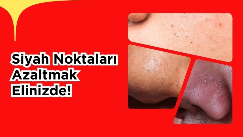 NEUTROGENA Türkiye’nin YouTube kanalına konuk olan Dermatoloji Uzmanı Prof. Dr.