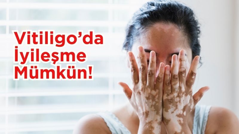 Medical Point Hastaneler Grubu’nun YouTube kanalında yayınlanan videoda Dr. Kerem