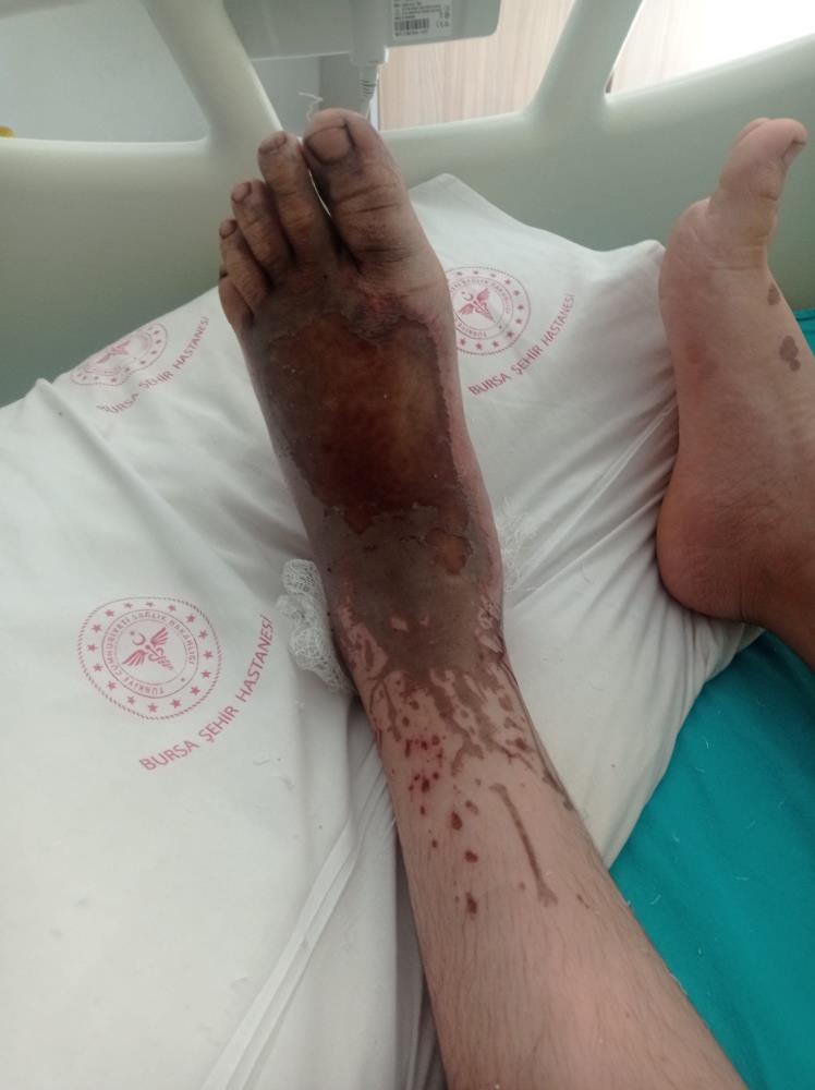 Fabrikanın Bıraktığı Asit Hayatını Kararttı! AW521136 02 - Marmara Bölge Gazetesi