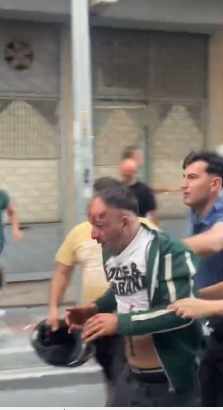 İşten Atıldı, Kadını Sokakta Bıçakladı AW521618 02 - Marmara Bölge Gazetesi