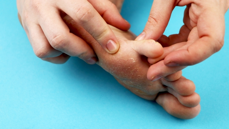 Balıkesirli vatandaşların da sıkça başvurduğu bu doğal maske, sadece 1