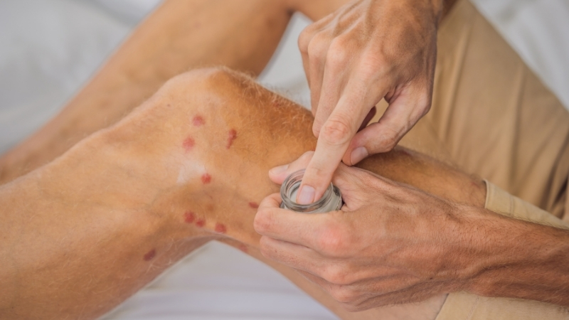 Balıkesir’de yaz akşamlarının keyfini çıkarırken sivrisinek ısırıklarının yol açtığı kaşıntı,