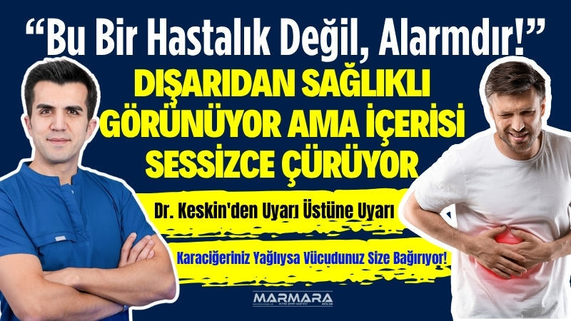 Doç. Dr. Muhammed Keskin, modern yaşamın getirdiği kötü alışkanlıkların karaciğer