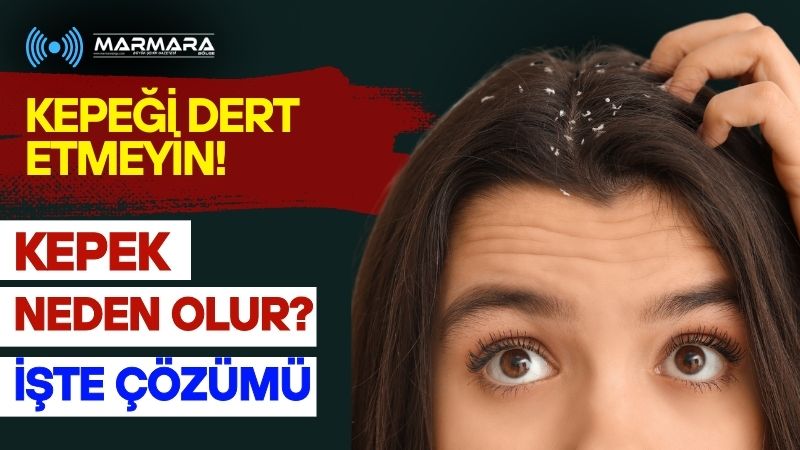 Dermatoloji uzmanı Dr. Ezgi Özkur, YouTube kanalında kepek sorununu ve