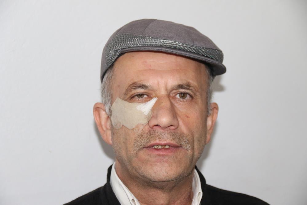 Komşu Dehşeti! Yürürken Saldırdı! AW544155 01 - Marmara Bölge Gazetesi