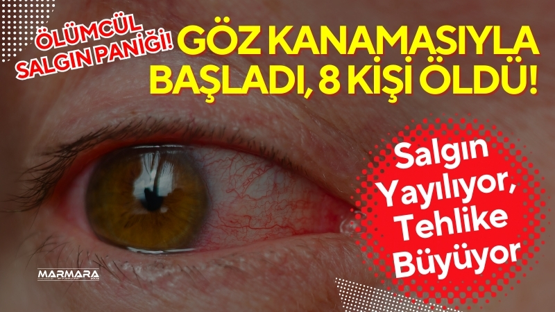 Demokratik Kongo’da göz ve burun kanamalarıyla başlayan gizemli hastalık, Marburg