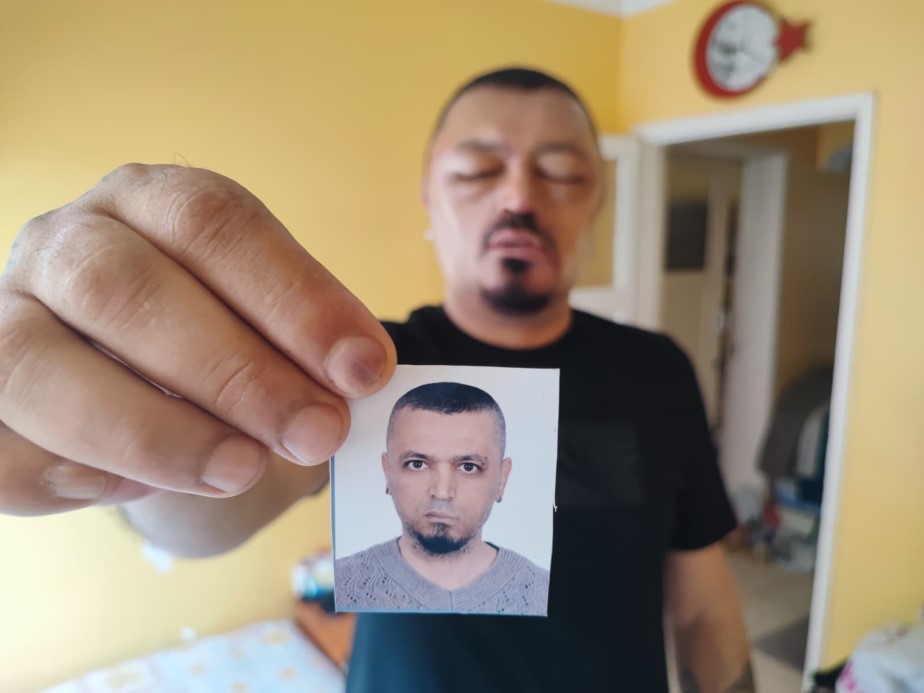 Şampuan Faciası: Yüzü Şişti aw532533 01 - Marmara Bölge Gazetesi