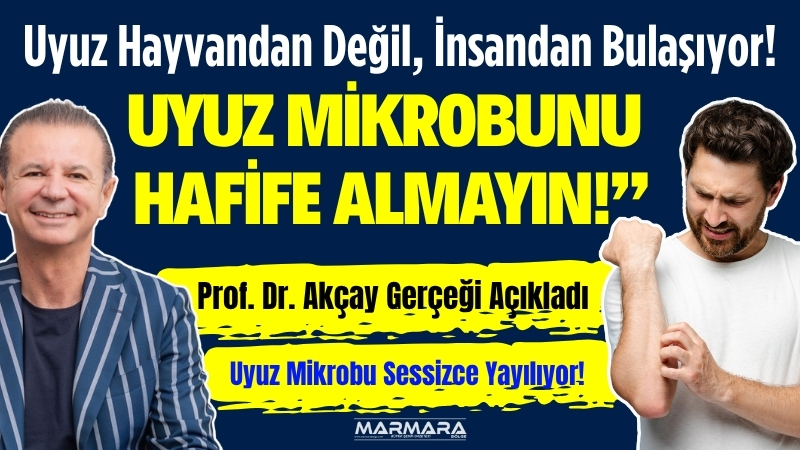 Prof. Dr. Ahmet Akçay, son dönemde artan uyuz vakalarına dikkat