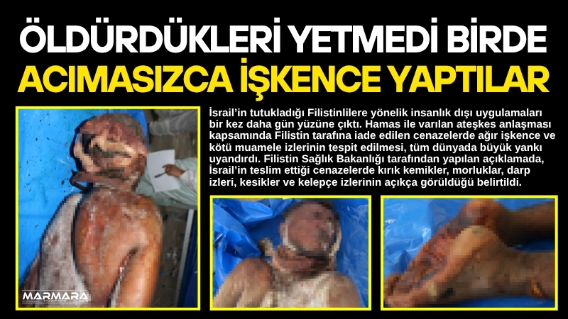 İsrail’in tutukladığı Filistinlilere yönelik insanlık dışı uygulamaları bir kez daha