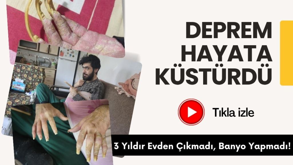 Hatay’da yaşayan 23 yaşındaki Barış Özbay, yaklaşık üç yıldır evinden