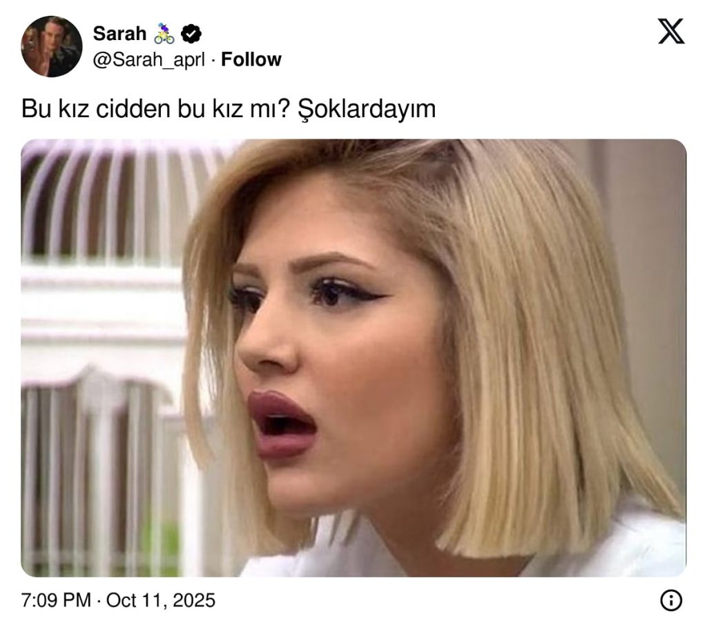 Eski Kısmetse Olur Yarışmacısı Dolgularını Eritince Değişimi Gündem Oldu s 008df8c1037132142b6a521da681da99dac27c00 - Marmara Bölge Gazetesi