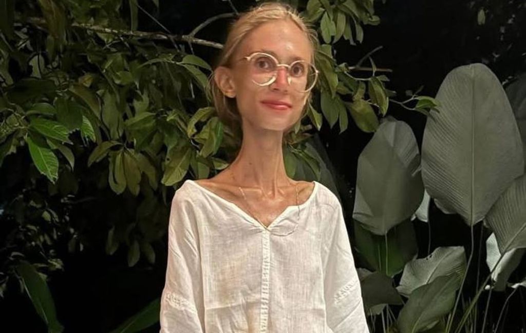 Frutaryen diyeti uygulayan genç fenomenin ölüm haberi sosyal medyada büyük