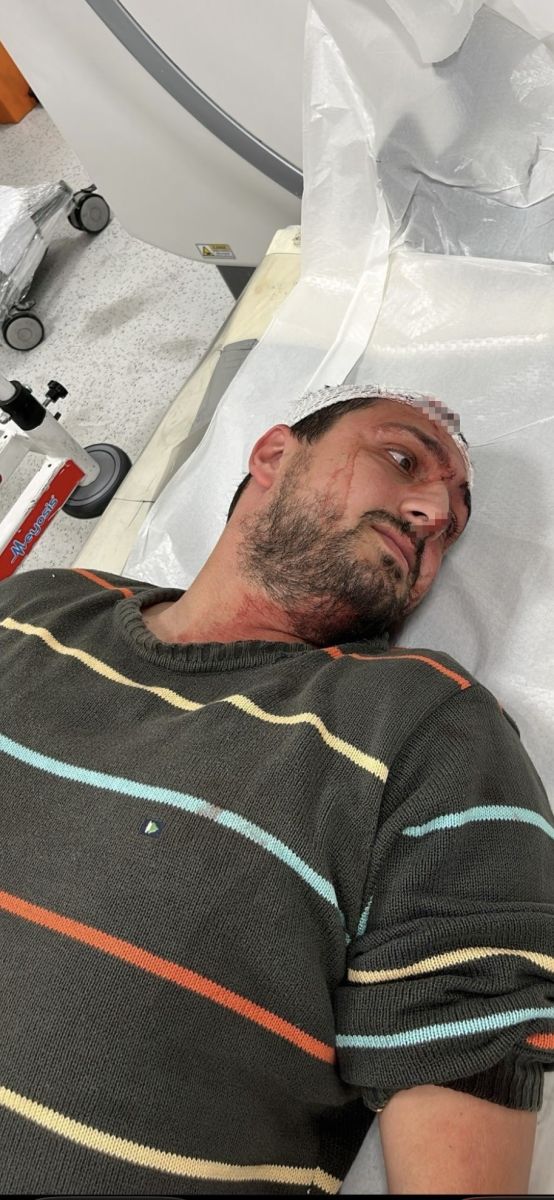 Fırın Çalışanından Utanç Verici Şiddet! Otizmli Genci Odunla Darp Etti AW583554 01 - Marmara Bölge Gazetesi