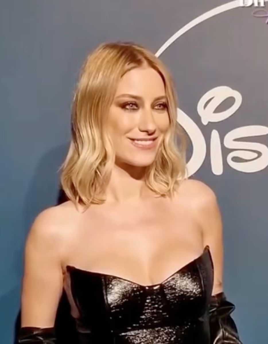 Hazal Kaya’nın Değişen Gülüşü Gündemde s 4ea336b99404eccbc06df937c7d68c14047c2f51 - Marmara Bölge Gazetesi