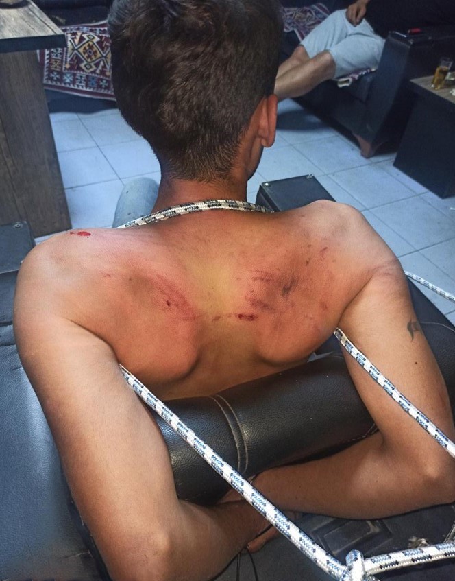 Antalya’daki İşkence Davasında Karar 1826 Gün Sonra Çıktı! AW595601 03 - Marmara Bölge Gazetesi