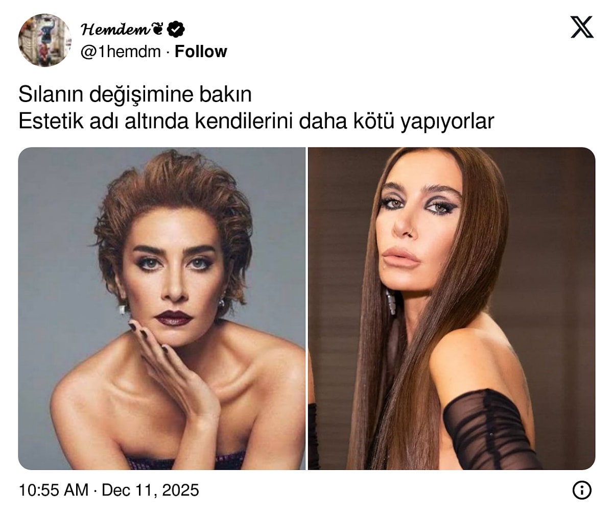 Şarkıcı Sıla’nın Son Hali Gündem Oldu s d5604eb9bfa9ee217ee0af3181d7f198b73013ae - Marmara Bölge Gazetesi