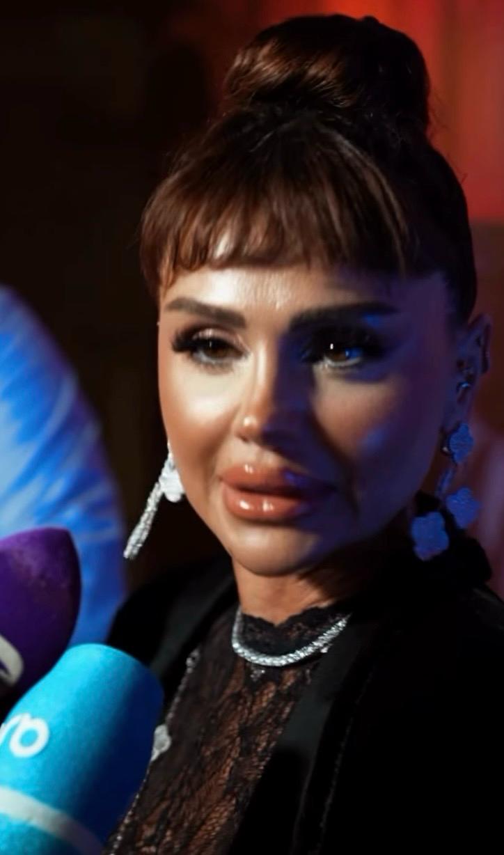 “Didem” Şarkısıyla Tanınan Günel Zeynalova’nın Son Hali Dikkat Çekti 4e42d4d2 1dc7 4e2b b0a8 764a606a7b0f - Marmara Bölge Gazetesi