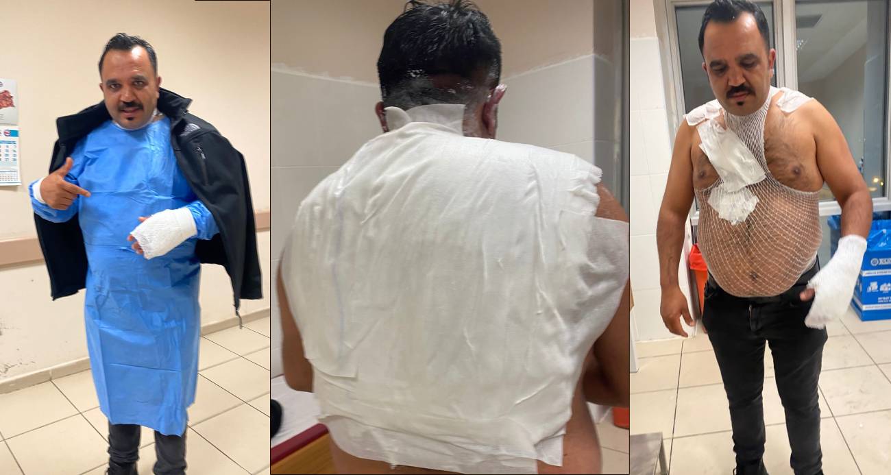 Şov Yapayım Derken Kendini Yaktı yeni proje 18 - Marmara Bölge Gazetesi