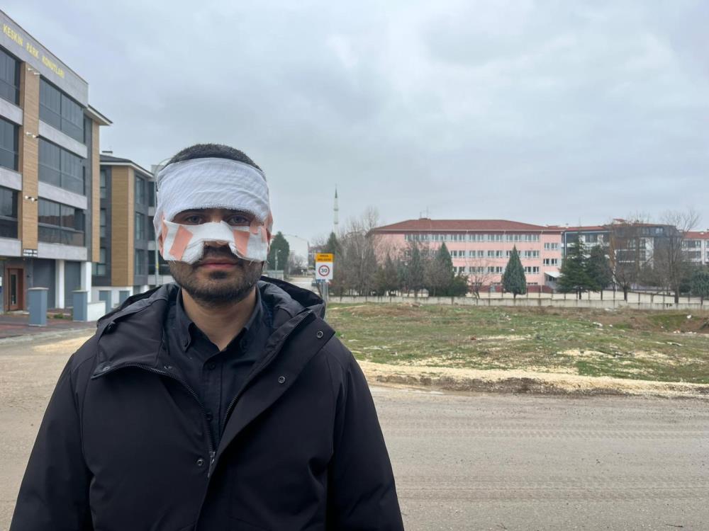 Lisede Şiddet İddiası: Öğretmenin Yüzü Kaynar Çayla Yandı! AW639926 01 - Marmara Bölge Gazetesi