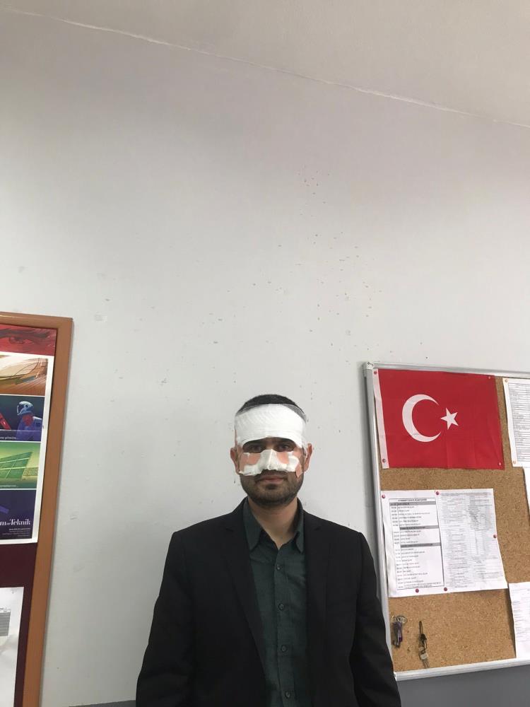Lisede Şiddet İddiası: Öğretmenin Yüzü Kaynar Çayla Yandı! AW639926 04 - Marmara Bölge Gazetesi
