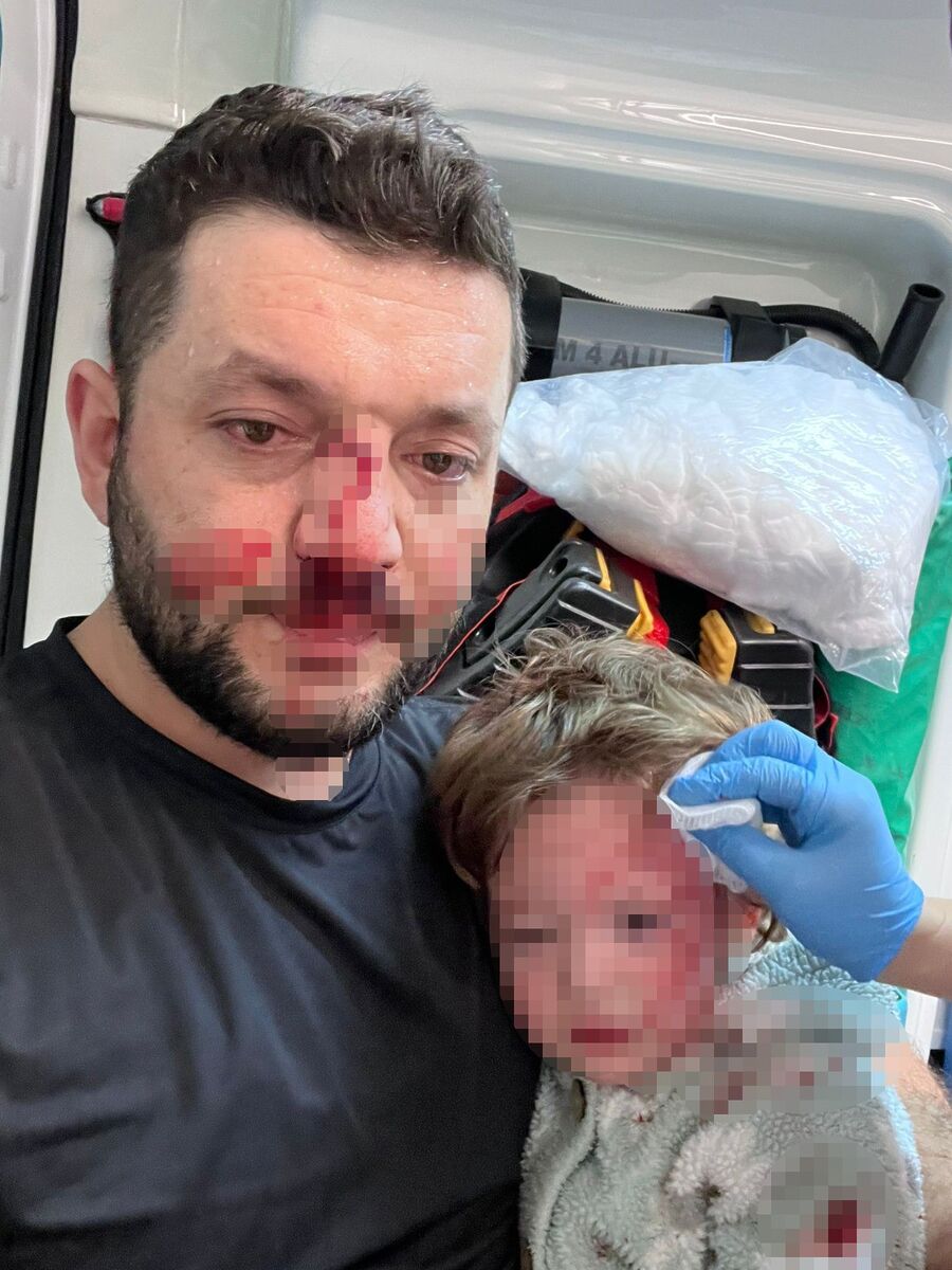 Gürültü Yüzünden Komşusuna Saldırdı, Baba Ve 14 Aylık Bebek Yaralandı AW647626 01 - Marmara Bölge Gazetesi