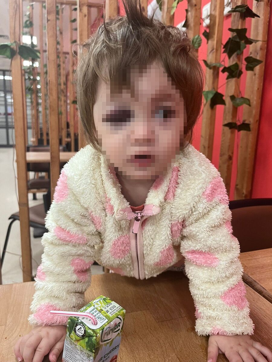 Gürültü Yüzünden Komşusuna Saldırdı, Baba Ve 14 Aylık Bebek Yaralandı AW647626 02 - Marmara Bölge Gazetesi