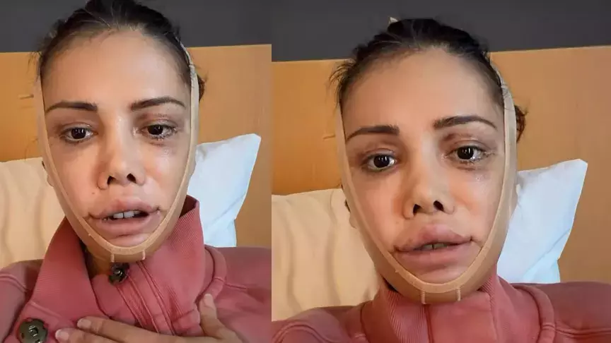 Didem Ceran, Güney Kore’de geçirdiği yüz nakli operasyonunun ardından son