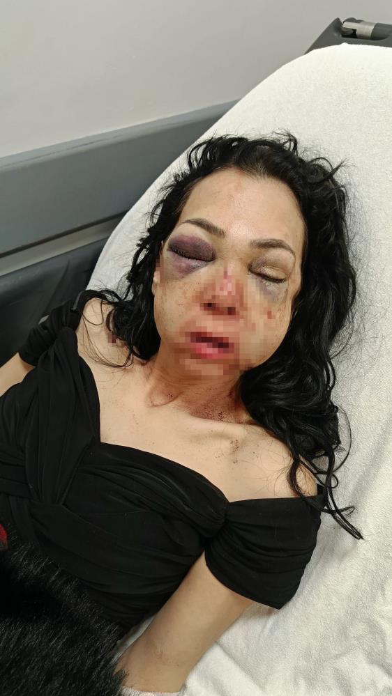 Eğlence Mekanındaki Dehşette Şüpheliler: “Merdivenlerden Düştü” AW681869 04 - Marmara Bölge Gazetesi