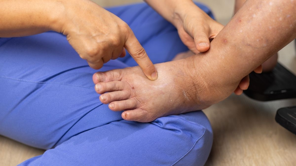 Ünlü doktor Canan Karatay, ayak şişliklerinin yalnızca hastalık değil hareketsizlik,