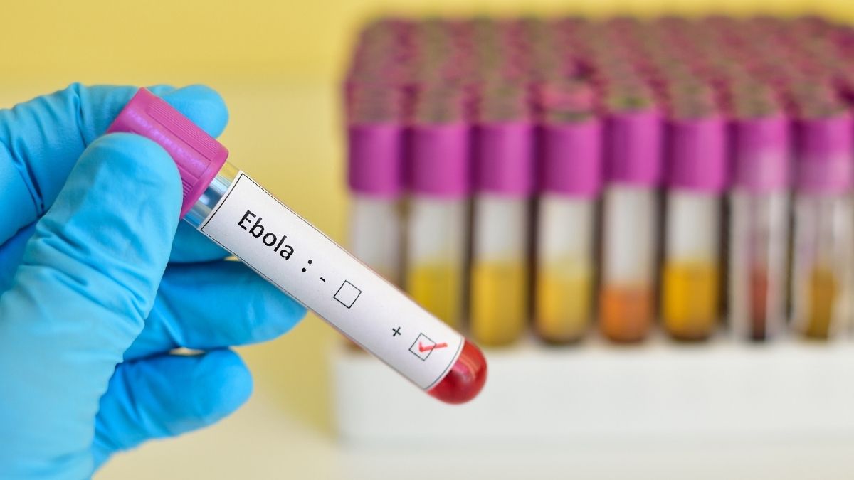 ebola virusu 5 - Marmara Bölge Gazetesi