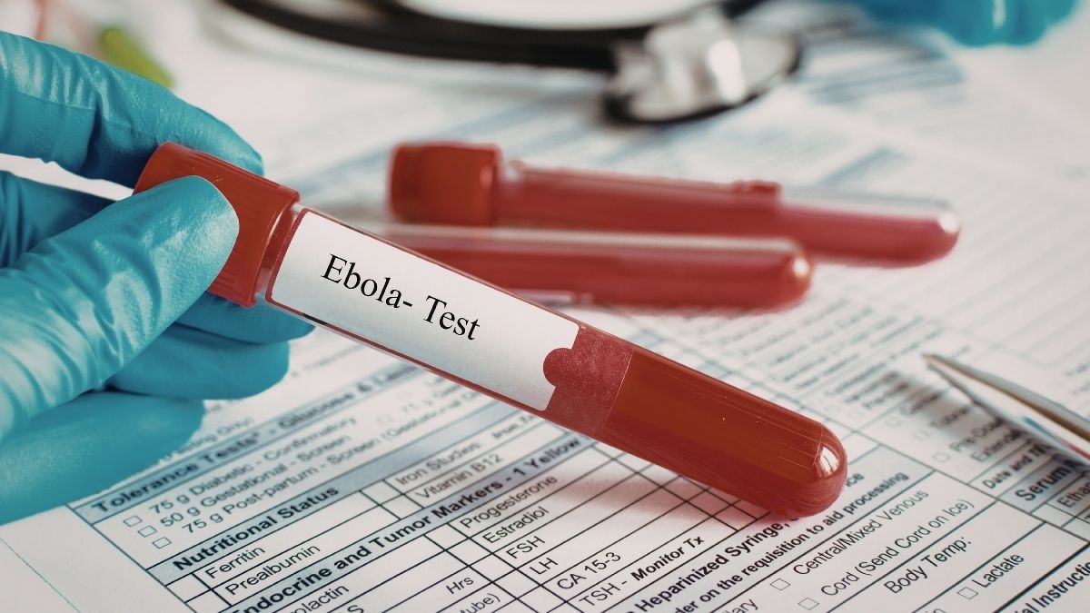 Ebola Virüsü Nedir, Nasıl Yayılır, Belirtileri Neler, Türkiye İçin Risk Var Mı? İşte Merak Edilen Tüm Detaylar… ebola virusu 9 - Marmara Bölge Gazetesi