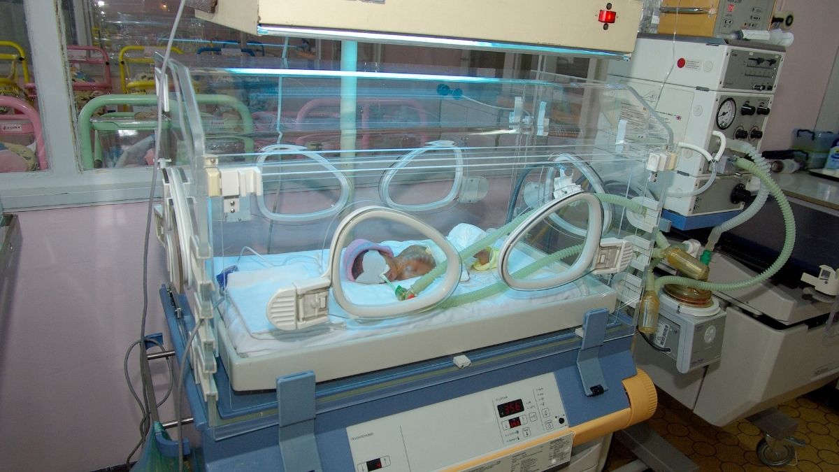 Bir Yenidoğan Skandalı Daha: 17 Günlük Bebek Kuvözde Yandı haber gorseli 2026 05 18T175911.354 - Marmara Bölge Gazetesi