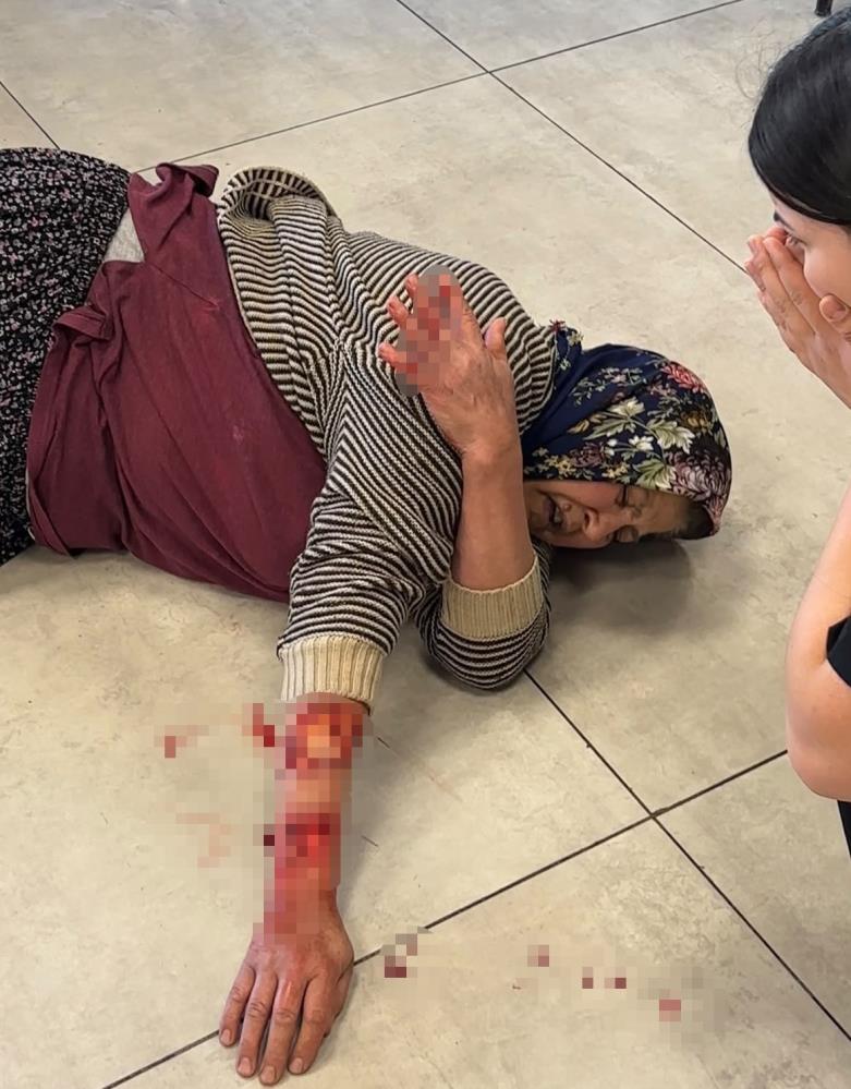 Dinlenme Tesisinde Dehşet! Başıboş Köpek Kadının Kolunu Kopardı AW725261 01 - Marmara Bölge Gazetesi
