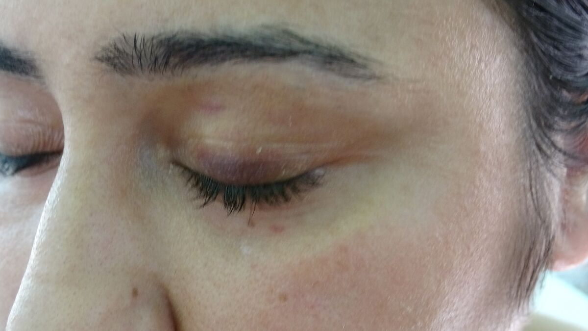 Genç Anne Bebeğinin Yanında 6 Kadının Saldırısına Uğradı! Genc Anne Bebeginin Yaninda 6 Kadinin Saldirisina Ugradi 1 - Marmara Bölge Gazetesi